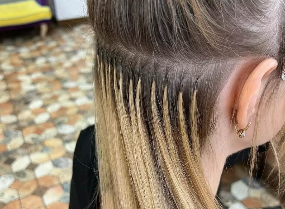 اکستنشن لیزری