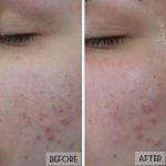 فیشیال صورت