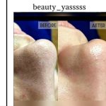 فیشیال صورت