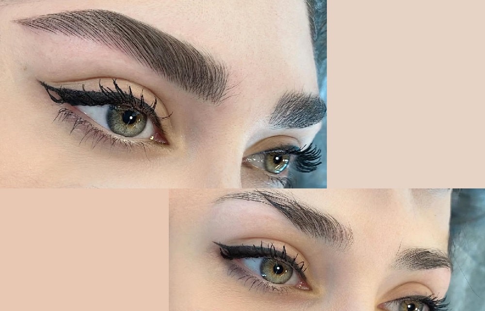 فیبروز ابرو