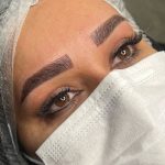 میکروبلیدینگ و فیبروز ابرو