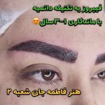 میکروبلیدینگ و فیبروز ابرو