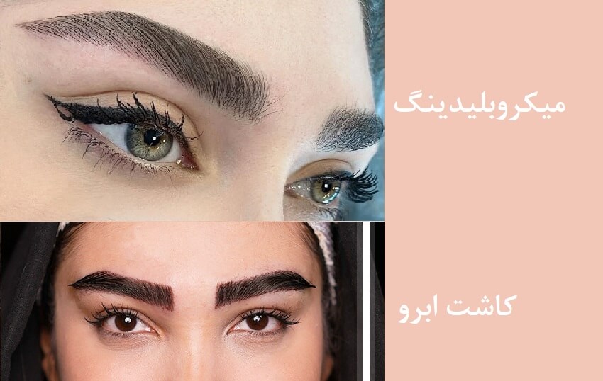 میکروبلیدینگ یا کاشت ابرو