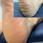 پدیکور و مانیکور