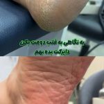 پدیکور و مانیکور