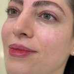 اصلاح صورت و ابرو