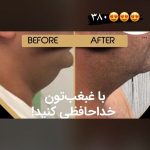 خدمات لاغری