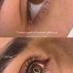 خط چشم و بن مژه دائم