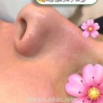 فیشیال صورت