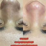 فیشیال صورت