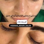 فیشیال صورت