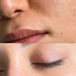 فیشیال صورت