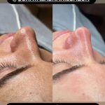 فیشیال صورت