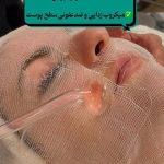 فیشیال صورت