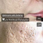 فیشیال صورت