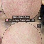 فیشیال صورت