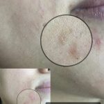 فیشیال صورت