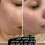 فیشیال صورت