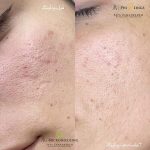 فیشیال صورت