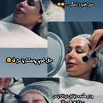 فیشیال صورت