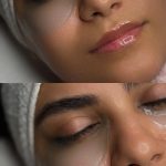 فیشیال صورت