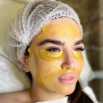 فیشیال صورت