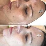 فیشیال صورت