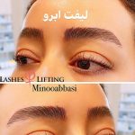 لیفت مژه و ابرو