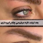 لیفت مژه و ابرو