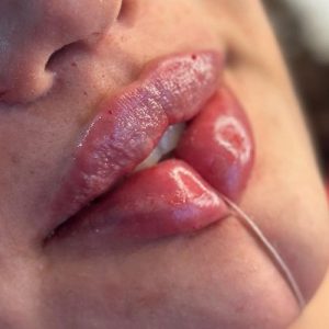 کلینیک زیبایی خورشید کرج