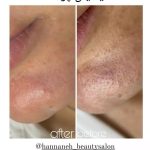 فیشیال صورت