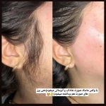 اصلاح صورت و ابرو