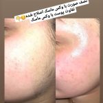 اصلاح صورت و ابرو