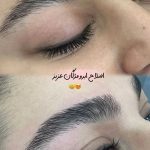 اصلاح صورت و ابرو