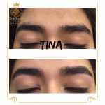 اصلاح صورت و ابرو