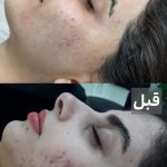 فیشیال صورت