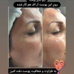 سالن زیبایی ساناز تبریز