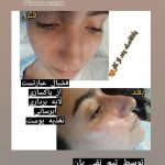 سالن زیبایی ساناز تبریز