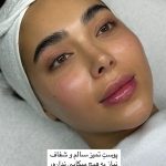 فیشیال صورت