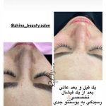 فیشیال صورت