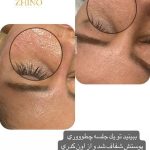 فیشیال صورت