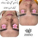 فیشیال صورت