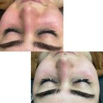 فیشیال صورت