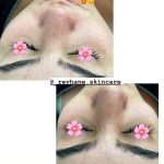 فیشیال صورت