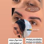 لیفت مژه و ابرو
