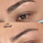 لیفت مژه و ابرو