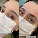 لیفت مژه و ابرو