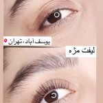 لیفت مژه و ابرو