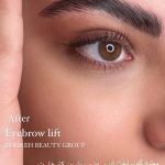 لیفت مژه و ابرو