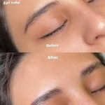 لیفت مژه و ابرو